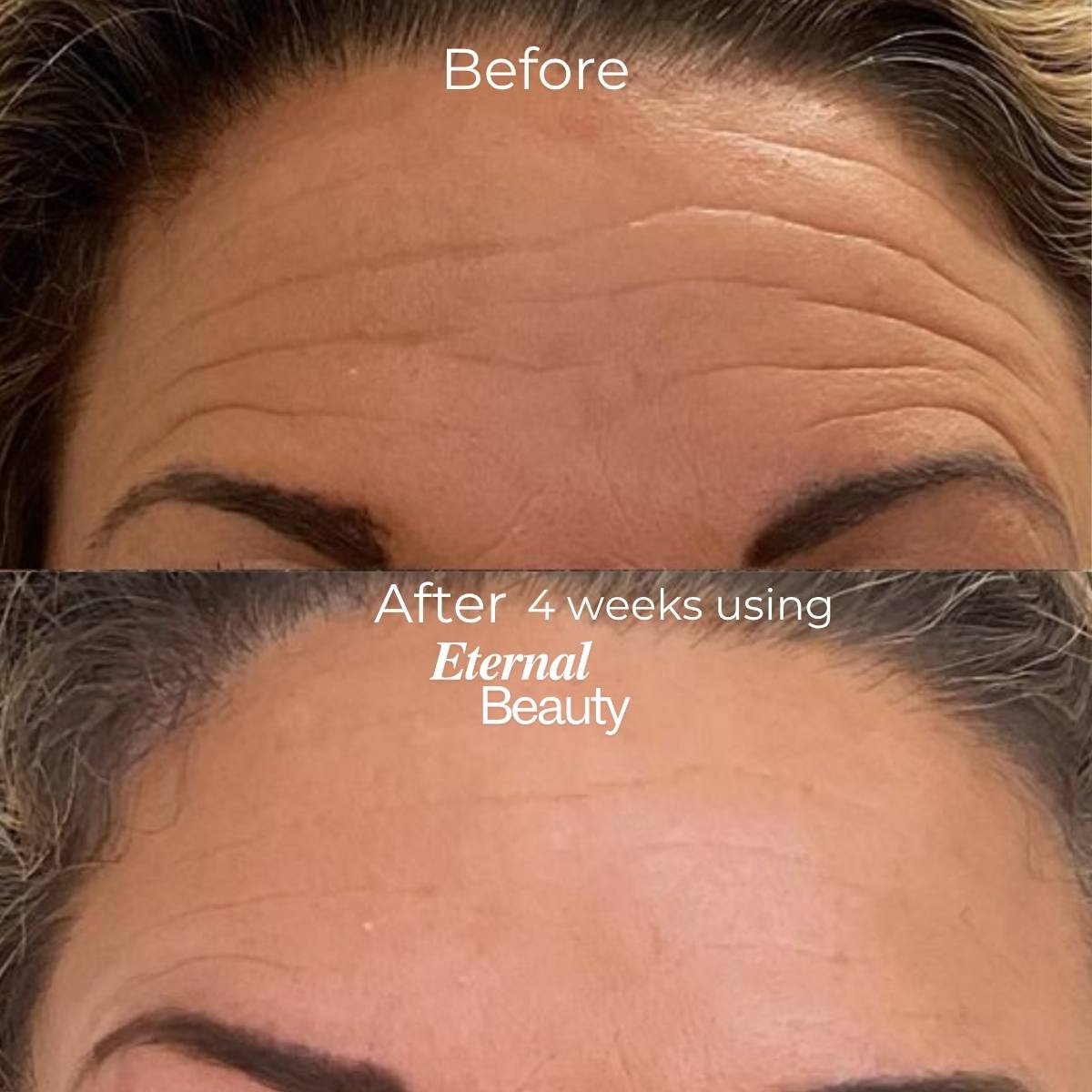 Silicon Collagen Tape