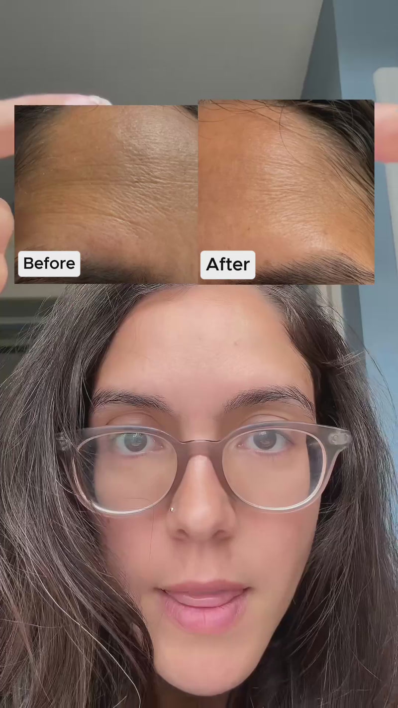No Botox. Just Silicon Tape.